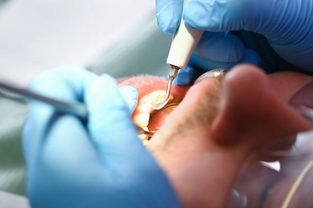 Tooth Infection Emergency Dentist in NY